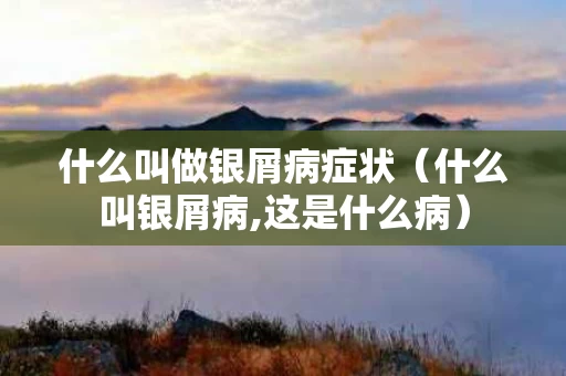 什么叫做银屑病症状（什么叫银屑病,这是什么病）